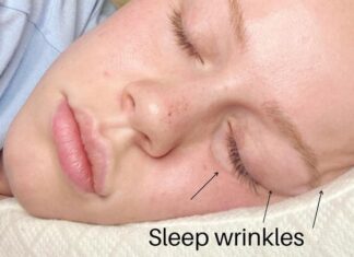 A Good Night’s Rest or a Wrinkle’s Worst: The Impact of Sleep Positions on Skin Aging