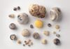 5 Key Differences Between Gallstones and Kidney Stones: Which is More Serious?