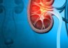 6 Early Signs of Kidney Failure: Be Aware and Take Action