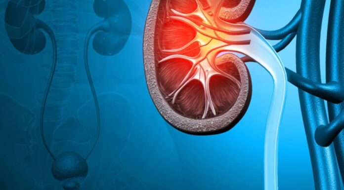6 Early Signs of Kidney Failure: Be Aware and Take Action