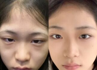 5 Emergency “First-Aid” Steps for Your Skin After Those Late Nights During Tết