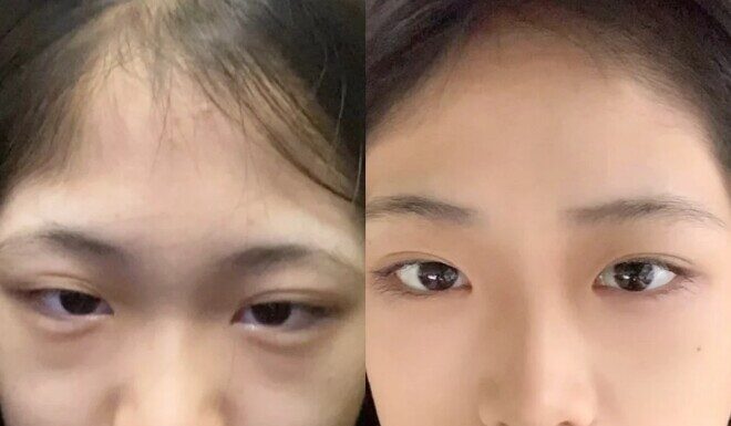 5 Emergency “First-Aid” Steps for Your Skin After Those Late Nights During Tết