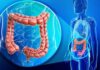 8 Early Warning Signs of Colon Cancer, #3 is Extremely Common