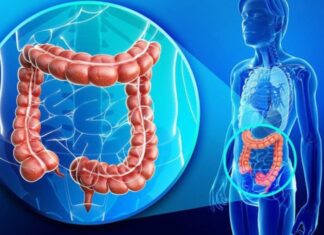 8 Early Warning Signs of Colon Cancer, #3 is Extremely Common