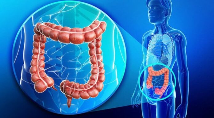 8 Early Warning Signs of Colon Cancer, #3 is Extremely Common
