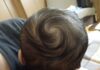 Does a Baby With More Hair Whorls Mean Higher Intelligence? Science Explains.