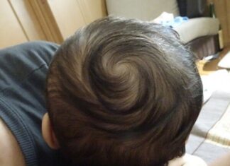Does a Baby With More Hair Whorls Mean Higher Intelligence? Science Explains.