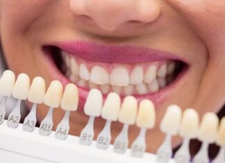 “Cosmetic Dental Veneers at Dang Luu Dental Clinic”