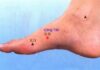 “The Emperor’s Meridian Point: Revitalizing Your Body’s Blood Flow with a Simple Foot Rub”