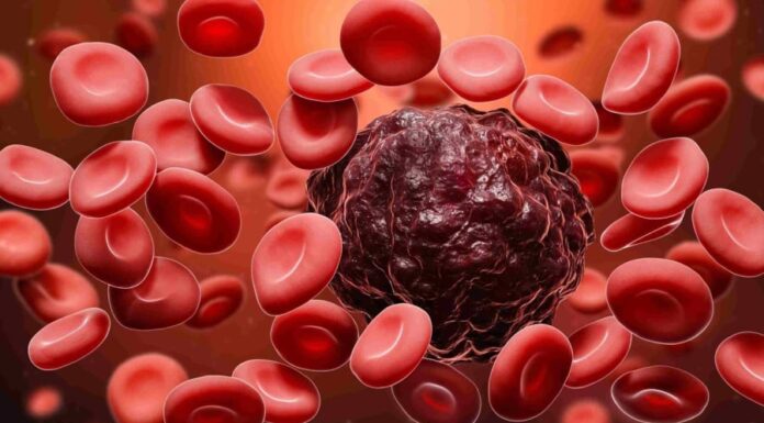 7 Silent Signs of Blood Cancer You May Be Unknowingly Ignoring