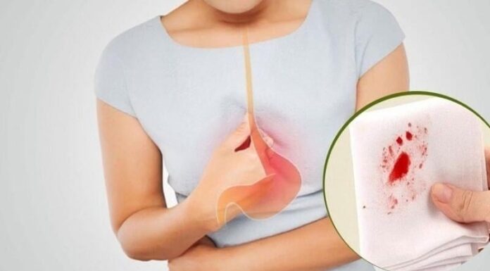 7 Warning Signs Your Stomach Ailment Has Progressed to a Severe Stage: Seek Immediate Medical Attention if You Experience Any of These