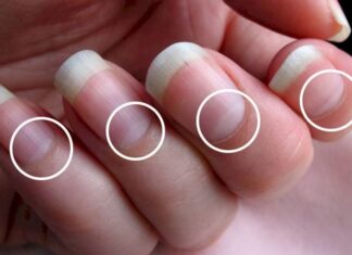 Diagnosing Health Issues Through Your Fingernails