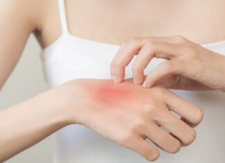 5 Warning Signs You May Have Advanced Kidney Disease: See a Doctor if You Experience Any of These