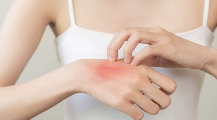 5 Warning Signs You May Have Advanced Kidney Disease: See a Doctor if You Experience Any of These