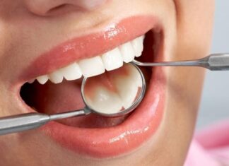 The Ultimate Guide to Painlessly Remove Stubborn Teeth Stains for a Brighter Smile.