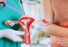 8 Warning Signs of Cervical Cancer: What Women Need to Know