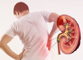 5 Warning Signs Your Kidney Disease Has Progressed: When to Seek Urgent Medical Attention