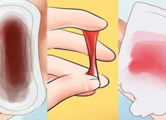 5 Early Signs of Cervical Cancer: Why 90% of Women Miss These Red Flags