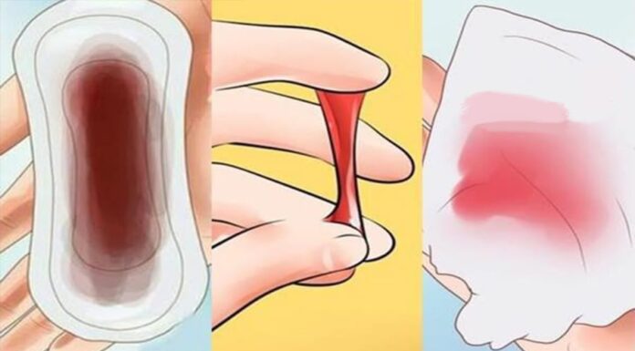 5 Early Signs of Cervical Cancer: Why 90% of Women Miss These Red Flags