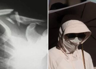 “The Sun-Shy Woman: A Tale of Unintended Consequences”