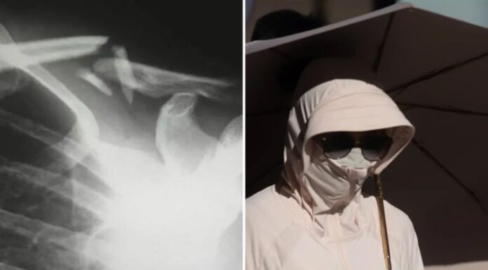 “The Sun-Shy Woman: A Tale of Unintended Consequences”