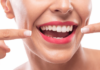 “Gorgeous Gums: The Secret to a Dazzling Smile for Women”