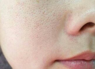 Unveiling Nature’s Secrets to Tighten Enlarged Facial Pores