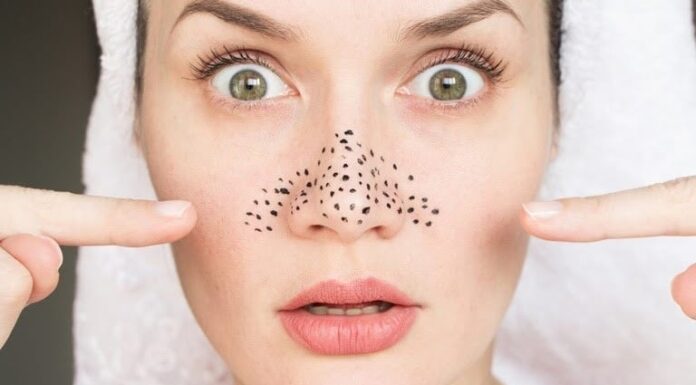 “A Clear and Glowing Guide to Blackhead Removal and Skin Care”