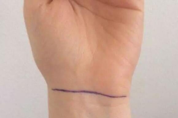 The Four Wrist Creases: Predicting a Life of Wealth or Struggle