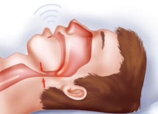 8 Early Signs of Kidney Disease: Catch Them Early, Save Your Life