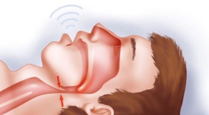 8 Early Signs of Kidney Disease: Catch Them Early, Save Your Life