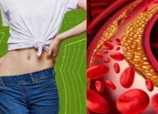 Is Being Overweight the Only Cause of High Cholesterol? Debunking the Myth.