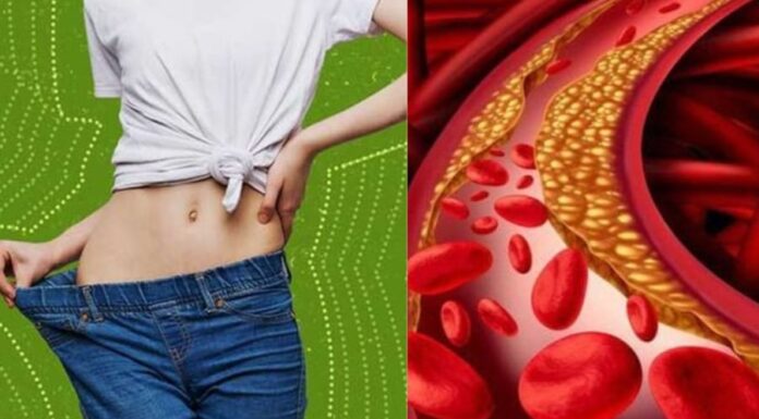 Is Being Overweight the Sole Cause of High Cholesterol? Debunking the Myth.