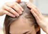 5 Hair Loss Reversal Methods: A Guide for Women Over 40 to Regain Confidence with a Full Head of Gorgeous Hair