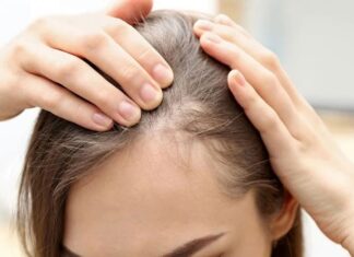 5 Hair Loss Reversal Methods: A Guide for Women Over 40 to Regain Confidence with a Full Head of Gorgeous Hair