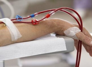 7 Warning Signs of Late-Stage Kidney Disease: Your Life May Depend on Recognizing These Symptoms