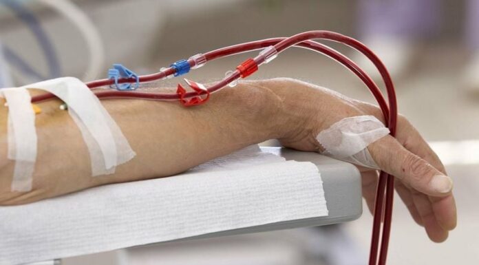 7 Warning Signs of Late-Stage Kidney Disease: Your Life May Depend on Recognizing These Symptoms