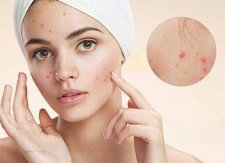 6 Foods That Are Secretly Ruining Your Skin