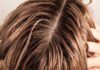 The Winter Hair Woes: Why Your Locks Get Greasy and Quick Fixes to Stay Fresh