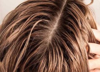 The Winter Hair Woes: Why Your Locks Get Greasy and Quick Fixes to Stay Fresh