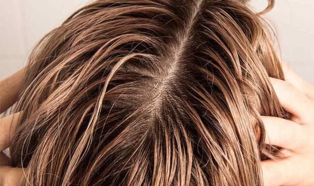 The Winter Hair Woes: Why Your Locks Get Greasy and Quick Fixes to Stay Fresh