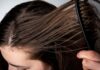 10 Life-Saving Hacks to Combat Greasy Hair and Scalp