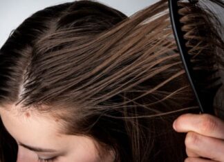 10 Life-Saving Hacks to Combat Greasy Hair and Scalp