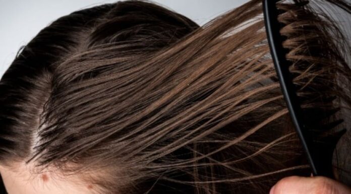 10 Life-Saving Hacks to Combat Greasy Hair and Scalp