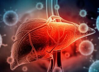 8 Warning Signs of Liver Cancer: When to See a Doctor to Prevent Late-Stage Metastasis