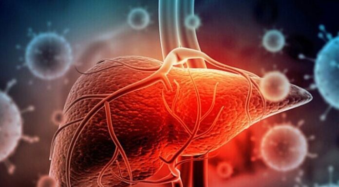 8 Warning Signs of Liver Cancer: When to See a Doctor to Prevent Late-Stage Metastasis