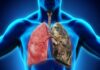 8 Warning Signs of Lung Cancer You Shouldn’t Ignore