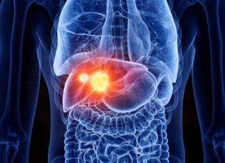 5 Nagging Pains That Could Be Warning Signs of Metastatic Cancer: Don’t Ignore These Symptoms