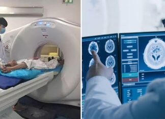 Four Symptoms of Liver Cancer in its Early Stages: Catching it Early Offers a Fighting Chance