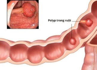 “The Disease That Increases Cancer Risk to Almost 100% After 40: Why You Shouldn’t Be Complacent”